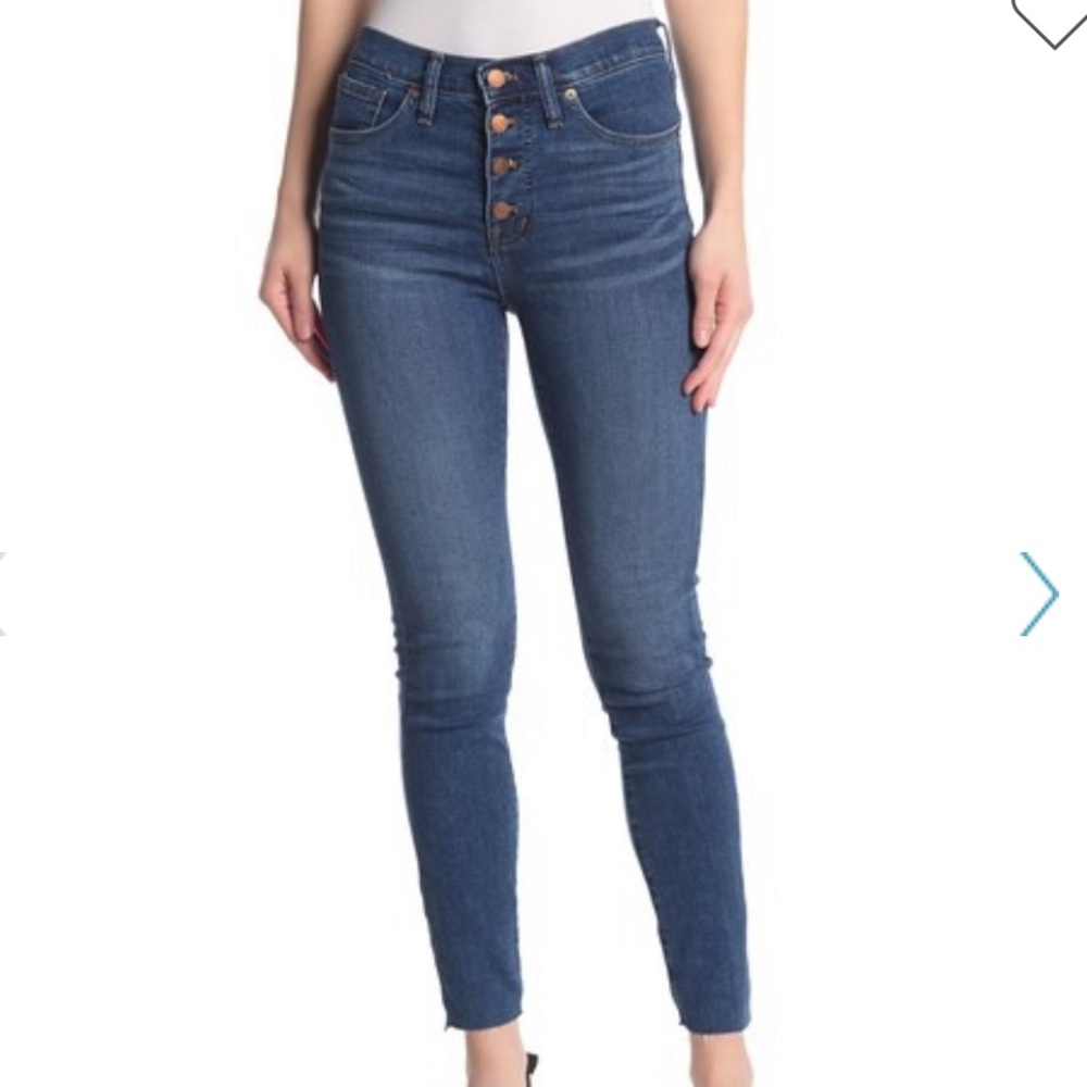 Madewell, Button Fly Mid Rise Skinny Jeans